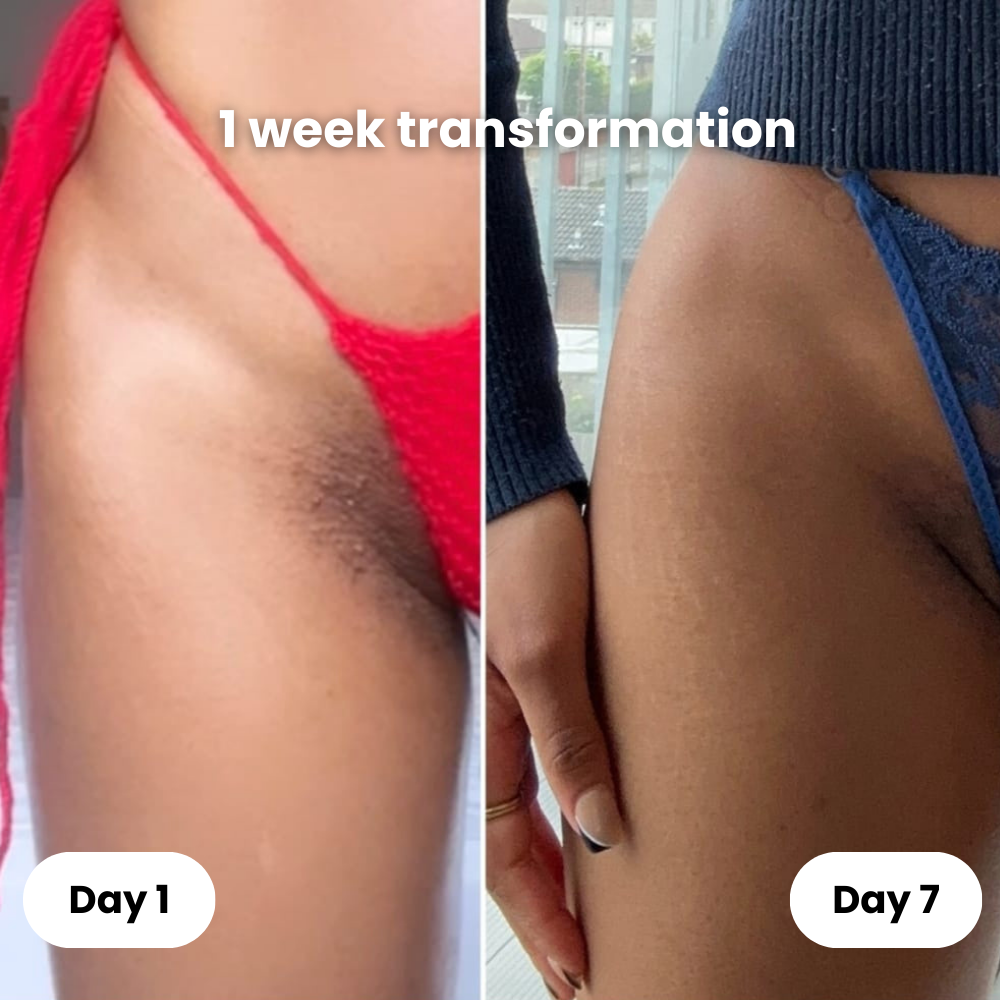 HaloSkin™ Smoothing Roll