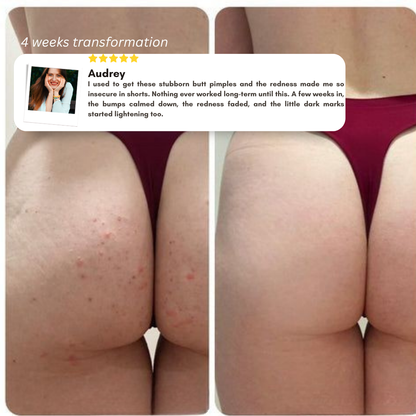 HaloSkin™ Smoothing Roll